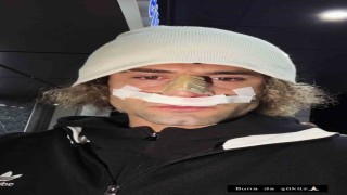 Elazığsporda Fuat Bavukun burnu kırıldı