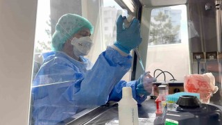 Eskişehirde düzey III Tüberküloz Laboratuvarı açılıyor