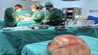 Vanda bir kadının karnından 35 santimetrelik dev kitle çıkarıldı
