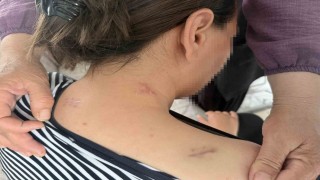 17 bıçak darbesi aldı, ölü numarasıyla kurtuldu, kocasının en ağır cezayı almasını istedi