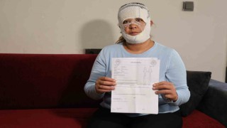 Güzelleşmek uğruna gittiği merkezde yüzü yandı