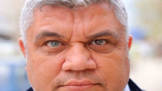 Kahramanmaraşlı adam 3 renkli gözleriyle görenlerin ilgisini çekiyor