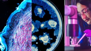 LOréal ve Institut Pasteurden cilt sağlığı biliminde iş birliği