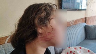 8 yaşındaki kızını darp eden çocuğun epilepsi hastası ablasını sokak ortasında dövdüğü iddiası