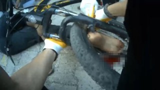 Osmaniyede ayağı bisikletin tekerine sıkışan çocuk ekiplerce kurtarıldı