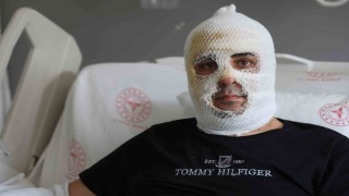 Ekmek teknesi küle dönmesin diye mücadele eden esnafın yüzü ve vücudu yaşanan patlamayla yandı