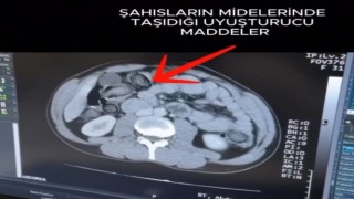 Mideye gizlenen uyuşturucu Erzincanda ele geçirildi