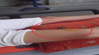Bahçeye kaçan topu almak isteyen çocuğun bacağına korkuluk demiri saplandı
