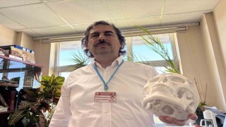 Beyin tümörü ameliyatı sonrası çöken alnı, 3 boyutlu implantla düzeltildi
