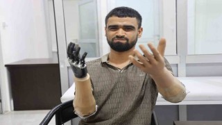 Demirin elektrik tellerine değmesiyle hayatı kararan Muhammed, 3 milyon TL değerindeki protez bacağına ve 2 biyonik koluna kavuştu