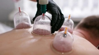 Hacamat uygulamasında hekim kontrolü ve steril ortamda yapılmalı