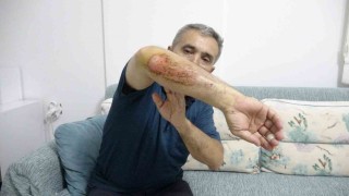 Otizmli oğluyla doğa gezisi sırasında sahipli köpeklerin saldırısına uğradı
