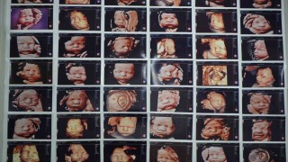 7 yıllık bebek hasreti kişiye özel tedaviyle son buldu