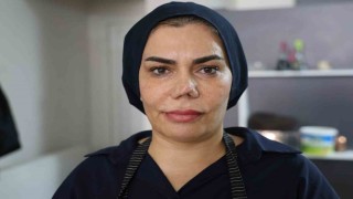 Bakım merkezinde burnu kırıldı, iyileşmek için geçirdiği 4 operasyon sonrası hayatı kabusa döndü