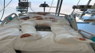 Otomobilin çarptıktan sonra üzerinden geçtiği genç kız ağır yaralandı