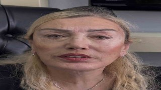 Ünlü estetikçiden Seda Sayanın ablasına estetik dokunuş