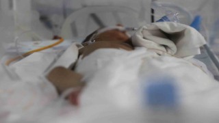 Bağırsak ameliyatıyla sağlığına kavuşan bin 300 gramlık Suriyeli prematüre bebeğin babasından Türkiye'ye övgü dolu sözler