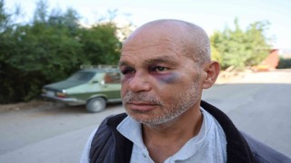 Duyma ve konuşma engelli adamı darp ettiler, aile şikayetçi oldu