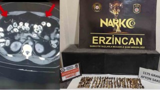 Erzincanda uyuşturucuyu vücutlarında taşıyan 3 şüpheli yakalandı