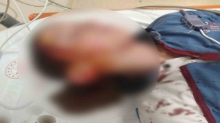 Köpek saldırısında yaralanan çocuk için 1 milyon 200 bin tazminat
