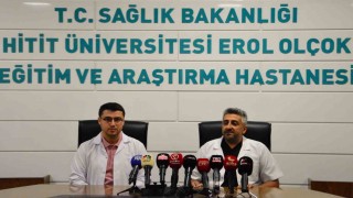 Vatandaşın boğazından çıkan canlı sülük doktorları bile şaşırttı: "İlk defa gördüm"